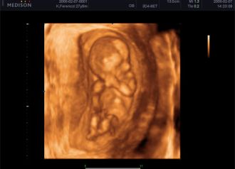 Csecsemő és gyermek ultrahang - illusztráció